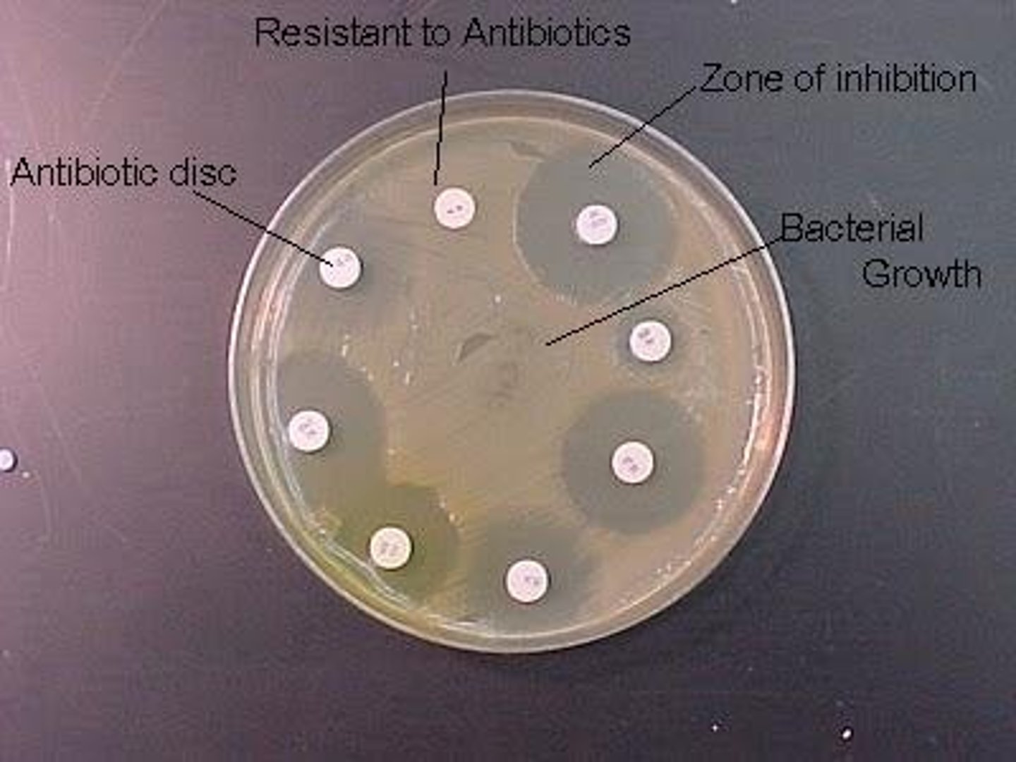 <p>-disks impregnated with specific drugs are placed on agar plates inoculated with test microbe in 0.5 McFargland Standard</p><p>-drug diffuses from disk into agar, establishing concentration gradient</p><p>-observe clear zones (no growth = zone of inhibition) around disks and compare to standard table</p><p>-reported as susceptible, intermediate, or resistant</p>