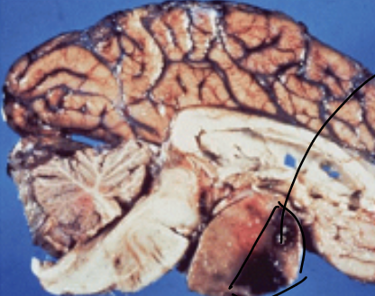 <p>gross shows </p>