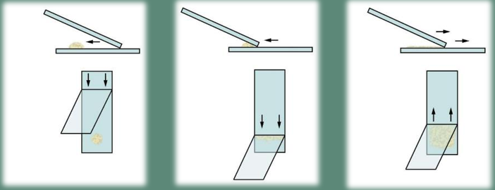<ul><li><p>This technique is slower than other, more preferred techniques </p></li><li><p>Cell degradation due to desiccation of the sample </p></li><li><p>Used for samples with suspected low cellularity e.g. fluid washes </p></li></ul><p></p>