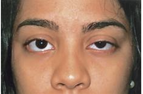 <p><span>How would you document the patient's left eye?</span></p><p></p>