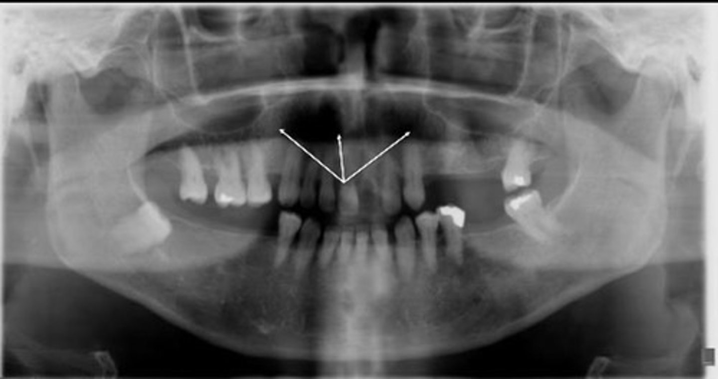 <p>Is this an ideal panoramic radiograph?</p>