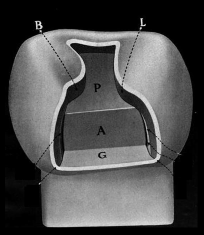 <p>Axial</p><p>Pulpal</p>