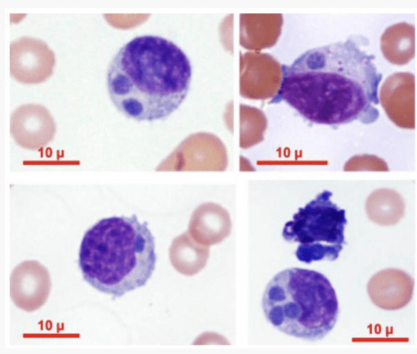 <p>Gram negative intracellular (white blood cells)</p><p>Affects the hematologic system</p><p>Causes fever, anaemia, bleeding disorders</p><p>Tick-borne</p>