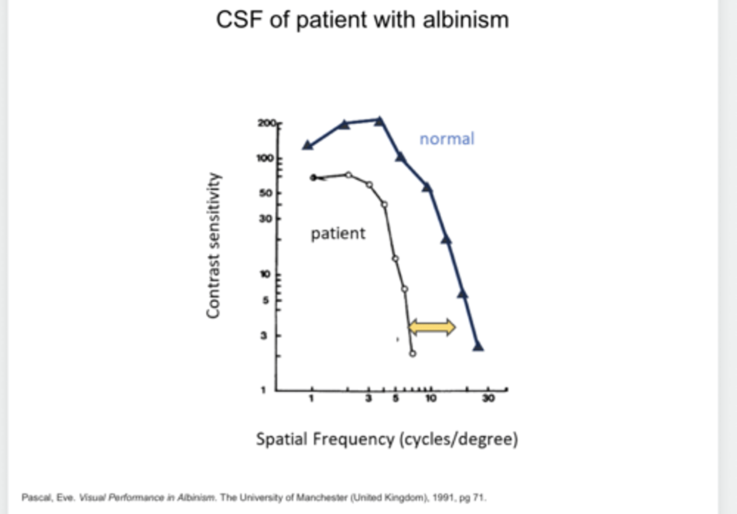 <p>Contrast Sensitivity Function in an Individual with Albinism -- Reduced from Normal (Pic)</p>