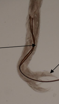 <p><span><span>Which morphological features shown in this picture help identify the sex of </span></span><em>Nematodirus</em><span><span>?</span></span></p>