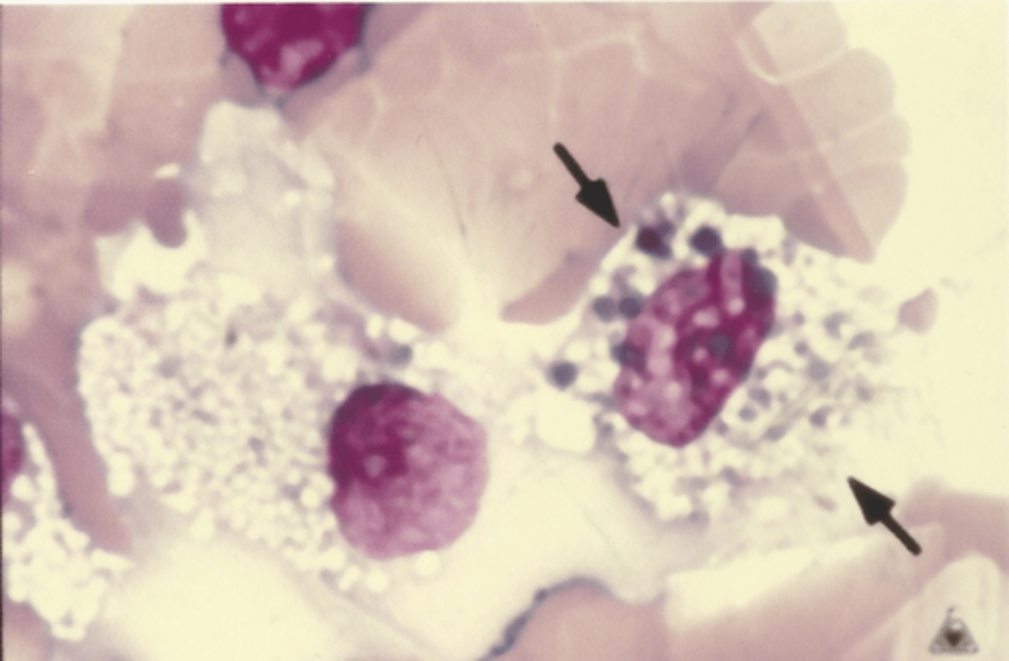 <p>Identify the cells in this body fluid</p>