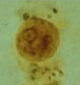 <ul><li><p><span>Same as E histolytica except for size</span></p></li><li><p><span>6-8u (5-10u)</span></p></li></ul><p></p>