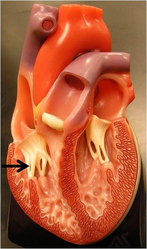 <p>Tendon-like cords that prevent the AV valves from inverting </p>