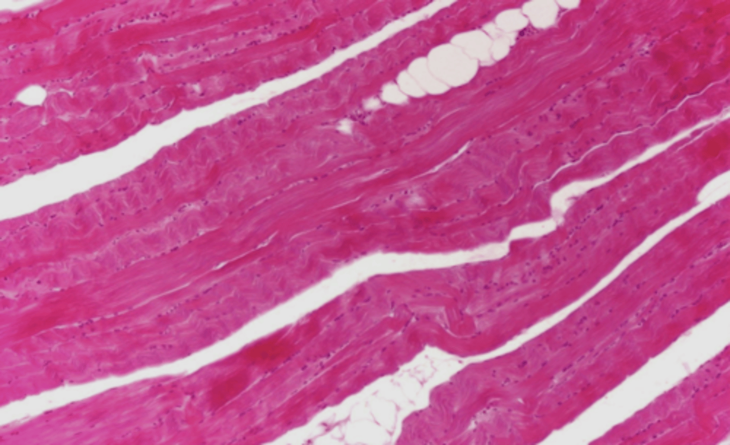 <p>what type of muscle tissue is this? how can you tell?</p>