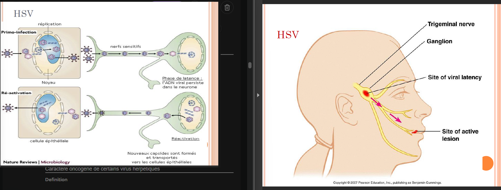 <p>= Herpes simplex virus</p><p>Caractéristiques =</p><p>ADN linéaire, de grande taille (>125 kpb) et avec des séquences répétitives</p><p>Virus enveloppés de grande taille avec tégument et capside hélicoïdale.</p><p>Région de protéines proches et tardive (prot. impliquée dans structure pour sortie des virions)</p><p>Répartition mondiale (67 % HSV-1)</p><p>Cytopathogène</p><p>Primo-infection (dans l’enfance)</p><p>Maladies récidivantes avec persistance du virus dans les cellules</p><p>Caractère oncogène de certains virus herpétiques</p><p></p><p>Affection vésiculaire de territoires muqueux</p><p>• <strong>Primo infections généralement inapparentes</strong></p><p>• Latence dans les neurones (ganglions sensitifs, sous forme d’épisome = cyclique et désactivé)</p><p>• Réactivation de virus latents quand affaiblissement du syst. immun.)</p><p>• Facteurs favorisants = Fièvre, UV, contrariétés, Infections, menstruations, <strong>immunité</strong></p><p></p><p>Vésicule herpétique = Nécrose cellulaire intra-épithéliale</p><p>Contagion via Salive ou rapports sexuels</p><p>! Porteurs sains</p><p></p><p>HSV 1 et 2 →</p><p>Les deux types peuvent infecter les muqueuses orales et génitales mais en général</p><p>Dépend du contact:</p><p>HSV 1 transmission plutôt <strong>orale, directe </strong>(ou par ustensiles souillés)</p><p>Mains → plaies et yeux</p><p>HSV 2 transmission <strong>sexuelle, </strong>! Mère vers enfant À l’accouchement (ou in utéro)</p><p></p><p>HSV1: </p><p>Complications =</p><p>Gingivo-stomatite,<strong> infection oculaire kératite herpétique</strong> → Entraîne la cécité, <strong>Eczéma herpétique</strong> chez des enfants atteints d’eczéma actif et <strong>Encéphalite herpétique </strong>(patients âgés, HIV+, etc..) → souvent mortelle</p><p>Récidive = herpès labial</p><p></p><p>HSV2:</p><p>Primo-infection asymptomatique mais lésions graves possibles</p><p>Récidives =</p><p>Pénis, col utérin, vagin et région ano-rectale</p><p><strong>Forme sévère</strong> → <strong>Herpès néonata</strong>l (risque: éruption vésiculeuse généralisée, encéphalite, hépatite, cécité)</p><p></p><p>Traitement =</p><ul><li><p>5 iodo déoxyuridine (IdU) et trifluorothymidine (TFT) en traitement local → contre HSV</p></li><li><p>Cytosine arabinoside et adénine arabinoside → contre HSV et VZV</p></li></ul><p><strong>→ Acycloguanosine (Acyclovir, Zovirax ) et valaciclovir</strong></p><p>ACG → ACG-P par thymidine kinase virale (svt pro-drogue → permet diminuer toxicité car sera toxique uniquement pour les cellules infercté)</p><ul><li><p><strong>Penciclovir</strong>, <strong>Famciclovir</strong></p></li><li><p><strong>Foscarnet </strong>(Foscavir): analogue du pyrophosphate → contre CMV, HSV, VZV</p></li></ul><p></p>