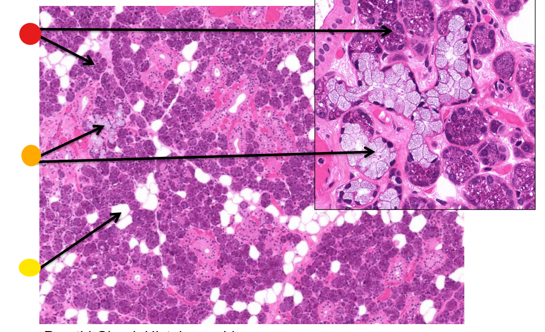 <p>What gland is this</p>