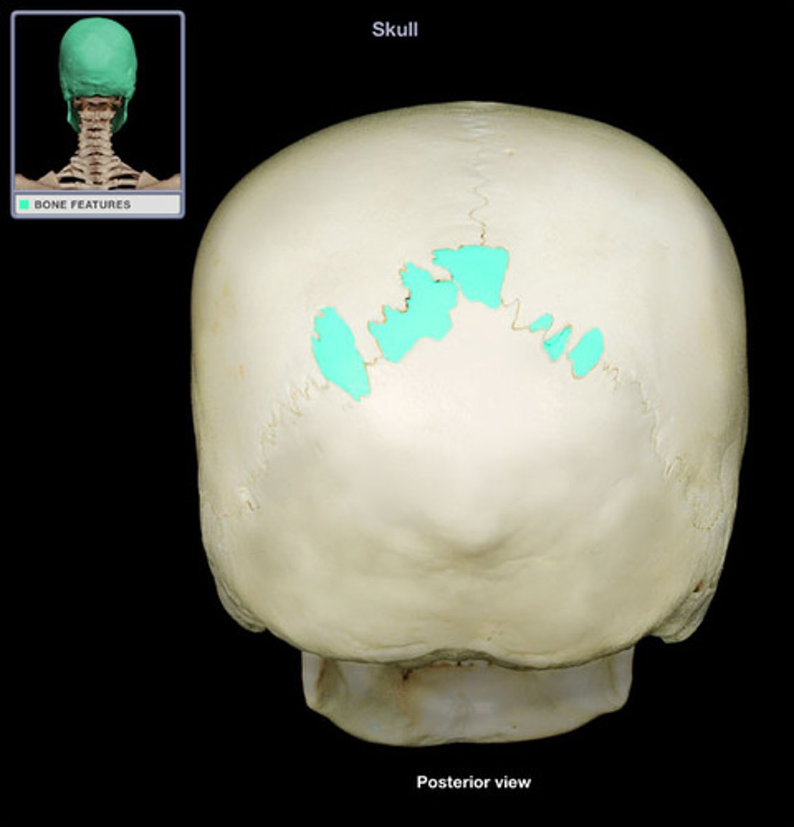 <p>tiny bones between cranial bones</p>