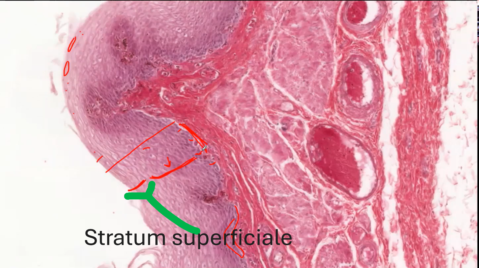 <p>Stratum Superficiale</p>