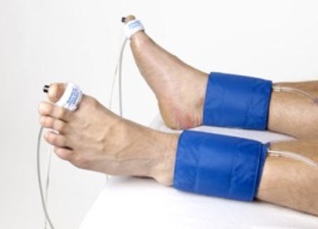 <p>When will we obtain toe tracings and TBI?</p>