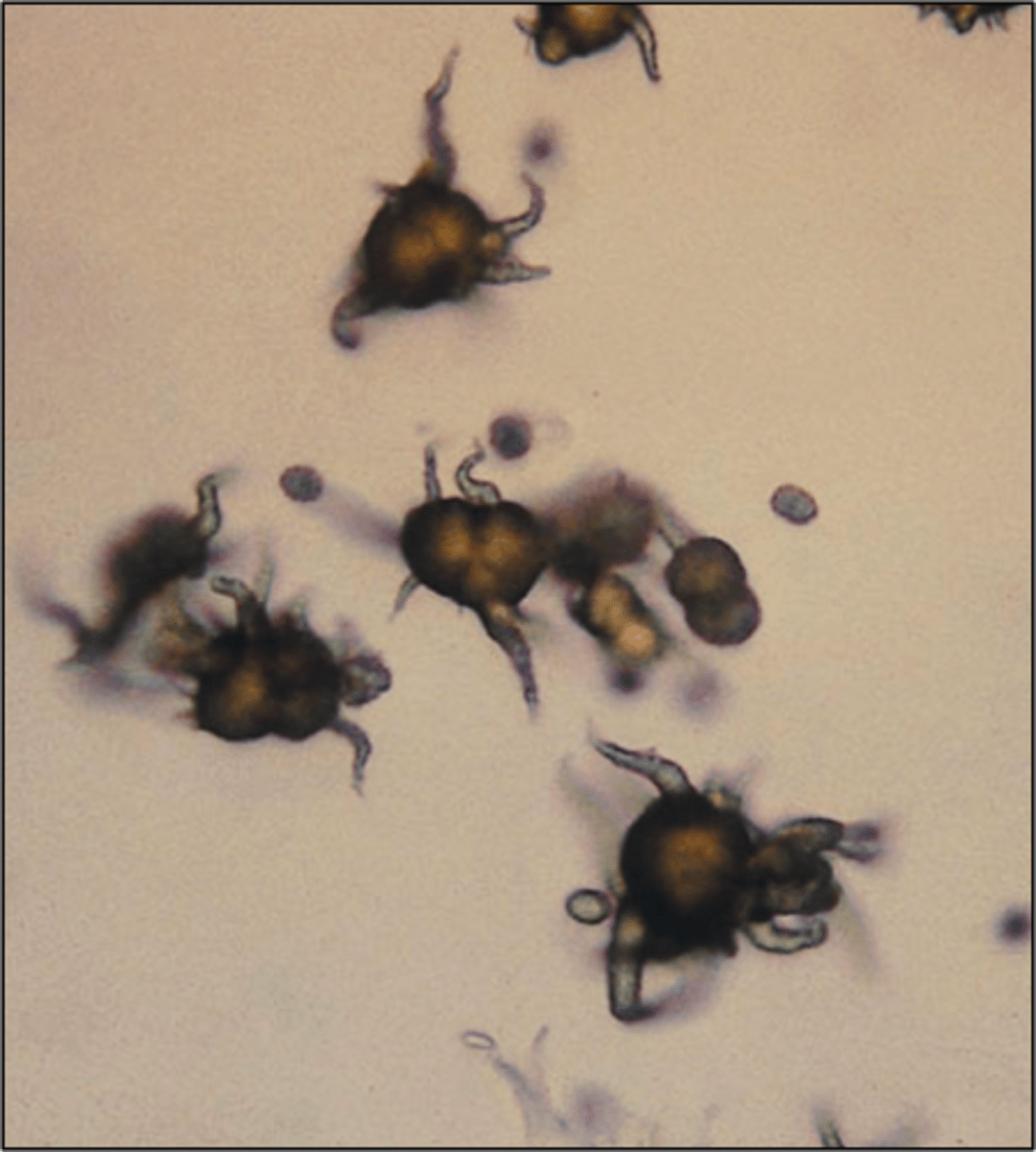 <p>alkaline urine, thorny apple phosphate, yellow brown</p>