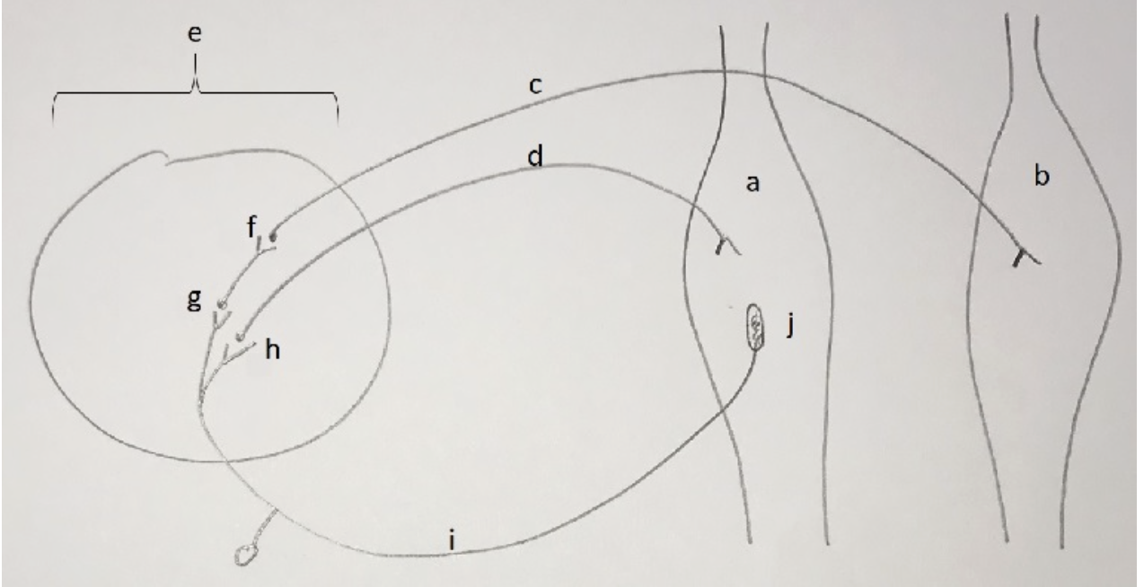 <p>In one of our lab activities we used proprioreceptive neuromuscular facilitation, PNF, to try to inhibit muscle contraction and thus improve the ability to stretch a muscle (in our experiment we were stretching the muscle). The following depicts the reflex arc for reciprocal inhibition of the hamstrings. Match the letters with the most appropriate description. Note: hamstrings are innervated by the sciatic nerve and quadriceps femoris by the femoral nerve.</p><p>i hamstrings</p><p>ii muscle spindle</p><p>iii afferent nerve</p><p>iv inhibitory synapse</p><p>v sciatic nerve</p><p>vi excitatory synapse</p>