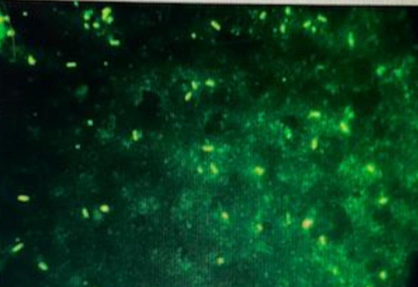 <p>The image presented is an immunofluorescent stained smear that is staining positively for c.haemolyticum. Which is considered to be the most important factor that triggers disease with this bacterium?</p><p>PGE</p><p>Starvation</p><p>Fasciola hepatica</p><p>Shipping fever</p><p>Salmonellosis</p>