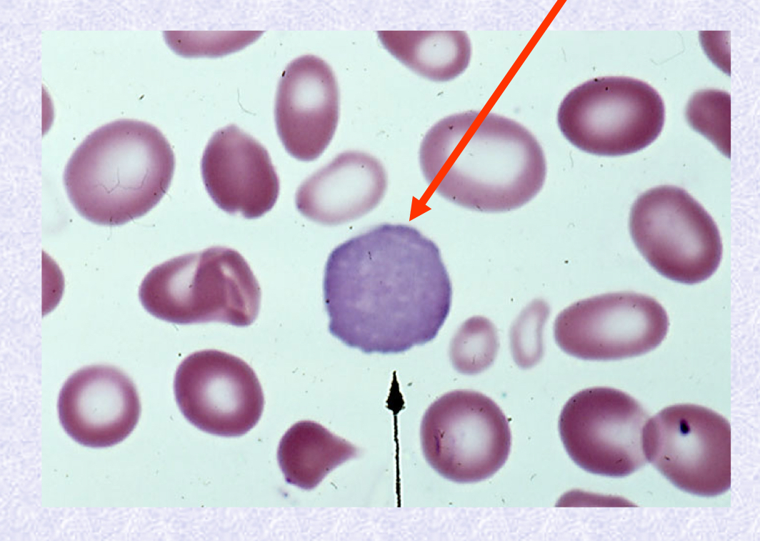<p>What normoblastic maturation stage is in the image?</p>