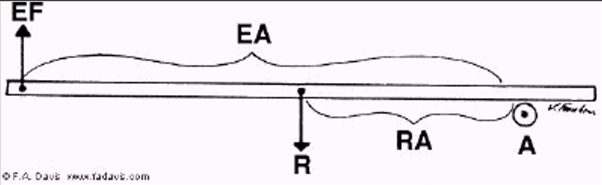 <p>What kind of lever is depicted?</p>