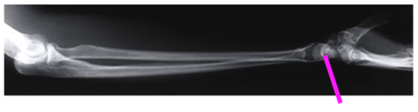 <p>what does this pink line point to?</p>