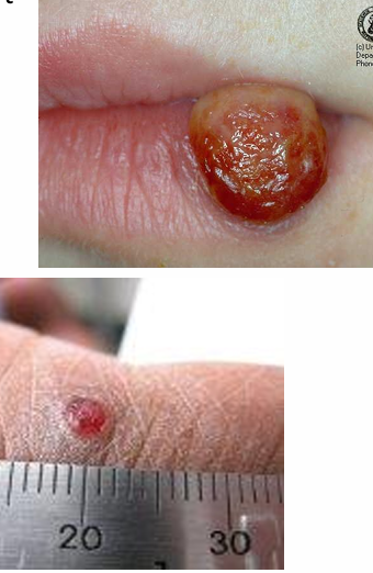 <p>Hoe heet dit klinisch beeld + uitleg? </p>