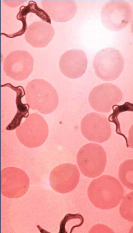 <p>What parasite is this?</p>