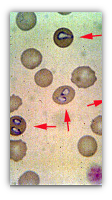 <p>Host: canine Intermediate host: ticks Location: within the RBC&apos;s Transmission: bite from an infected intermediate host Diagnosis: stained blood smears Clinical signs: pale mucus membranes, icterus (jaundice) anorexia Common name: Babesia Zoonotic? no Key fact: death can occur rapidly</p>