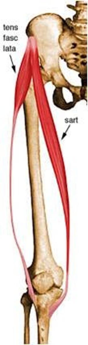 <p>Anterior iliac crest</p>