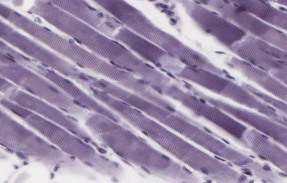 <p>What kind of tissue is this</p>