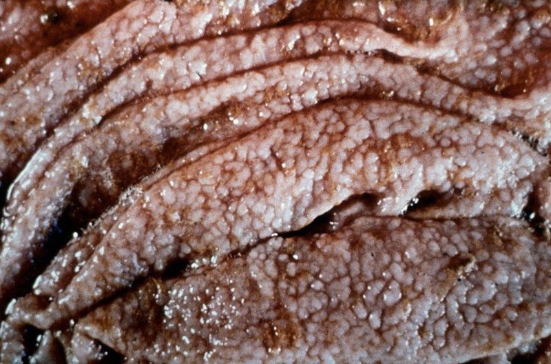 <p>Occurs mid to late favorable season (cool and wet climate) </p><ul><li><p>Large numbers of larvae are acquired from pasture, heavily contaminating the environment</p></li><li><p>This leads to substantial damage during their departure from the gastric glands, causing “Moroccan leather” appearance in the abomasum (pictured)</p></li><li><p>Young cattle is most susceptible</p></li></ul><p></p>