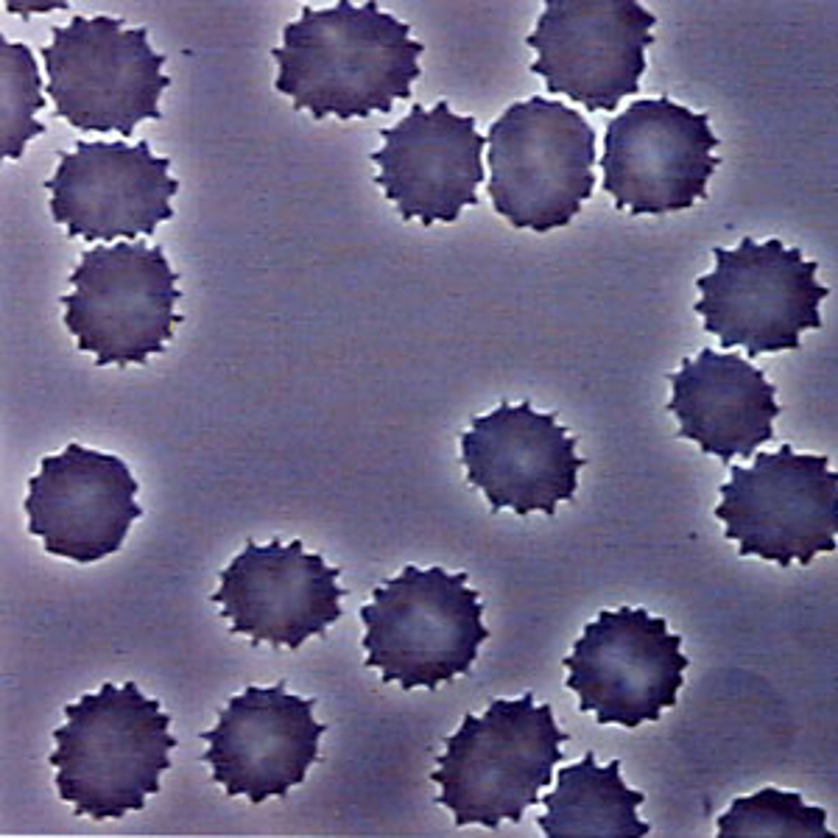 <p>evenly spaced crenation, non-specific disease, rattlesnake envenomation, blood transfusion</p>