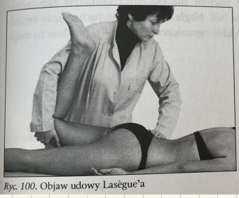 <p>Pozycja wyjściowa: leżenie przodem, podudzie kd. badanej zgięte </p><p>Wykonanie: badający jedną ręką podchwytem za udo unosi kd. pacjenta, a drugą ręką stabilizuje lędźwia </p><p>Interpretacja: w warunkach prawidłowych wykonanie przeprostu uda w stawie biodrowym jest niebolesne. Na podrażnienie korzeni nerwowych segmentu L3-L4 wskazuje ból w okolicy k. krzyżowej oraz na przedniej stronie uda</p>