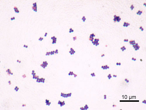 *Gram positive*, coccus morphology, part of normal microbial on skin, can cause pimples and boils if under skin or pneumonia or toxic shock syndrome, infections treated with antibiotics but some strains of bacteria resist