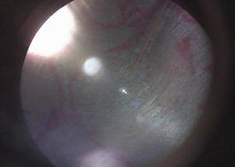 <p>Location: Line/covers most abdominal organs</p><p>Function: Quick diffusion &amp; reduces friction</p>