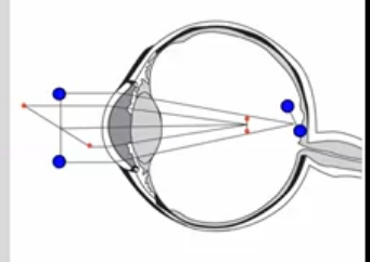 <p>image of a point object in an astigmatic eye&nbsp;</p>