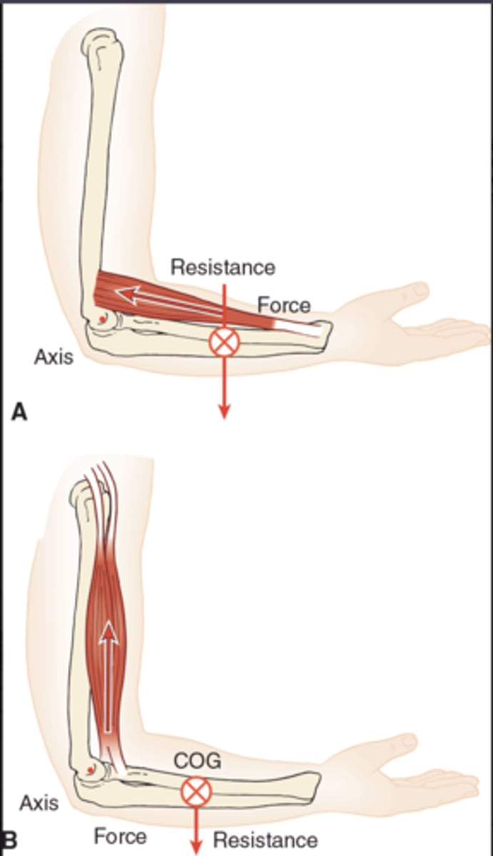 <p>Yes. Changing load or movement direction can shift which element is in the middle. Example: With elbow flexion, the brachioradialis can act as a second‑class lever (A-R-F). Adding a weight in the hand may move the resistance distal, creating a third‑class configuration (A-F-R).</p>
