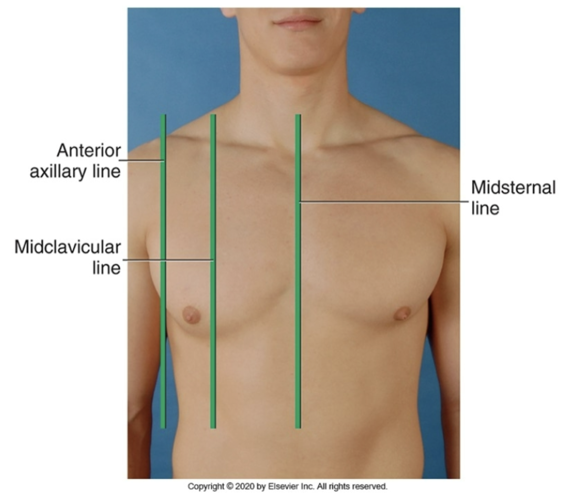 <p>anterior reference line running down the middle of the chest (middle of the sternum)</p>