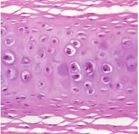 <p>(pink and glassy)</p>