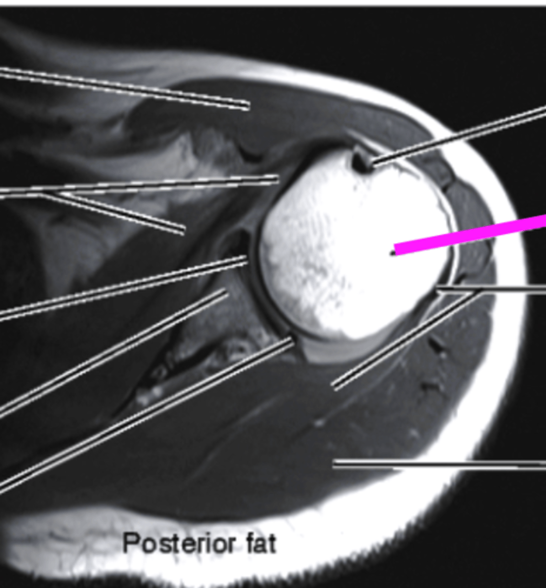 <p>what does the pink line point to?</p>