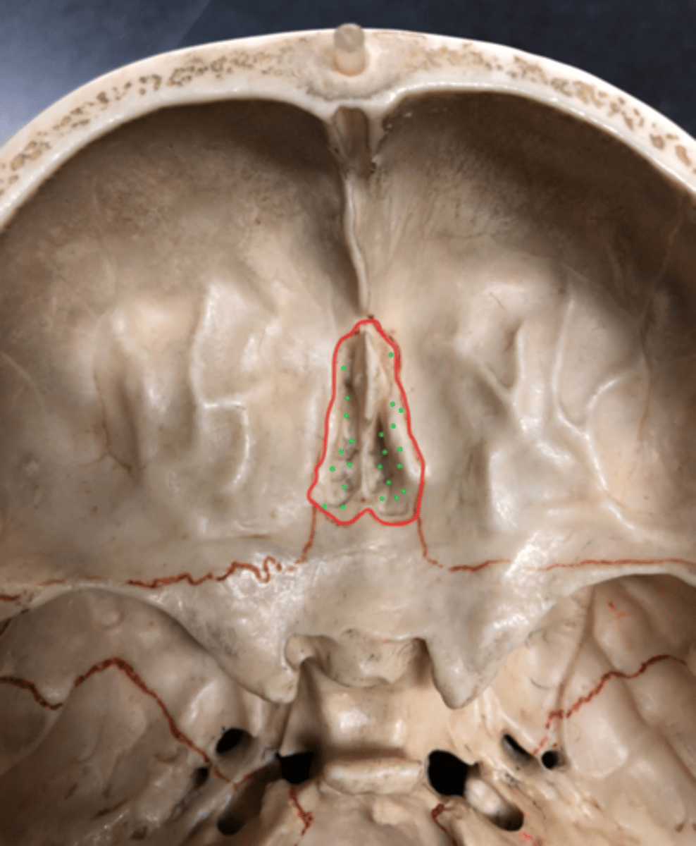 <p>Holes in cribriform plate<br>(the green dots on the pic)</p>