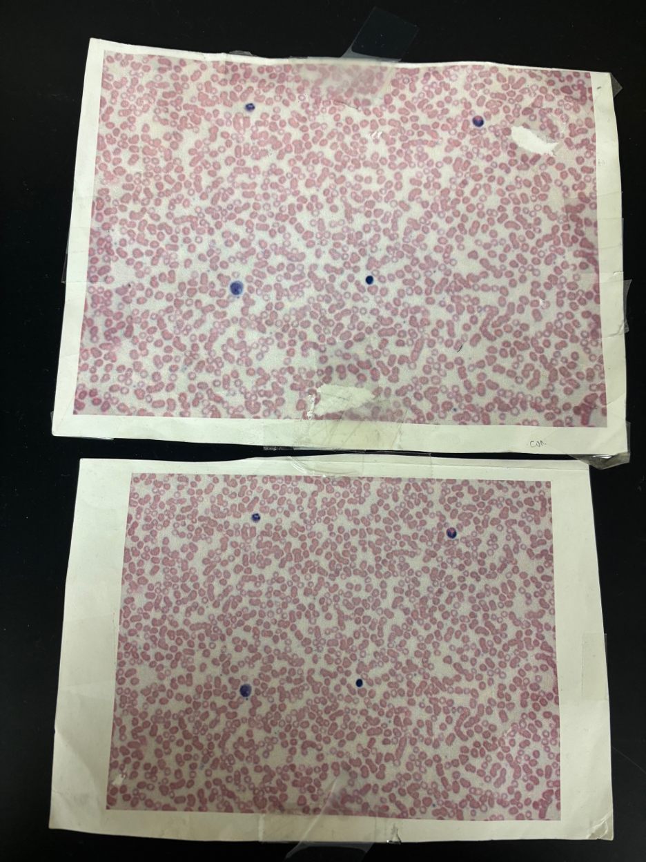 <p>What kind of blood/bone/tissue/cartilage is this?</p>