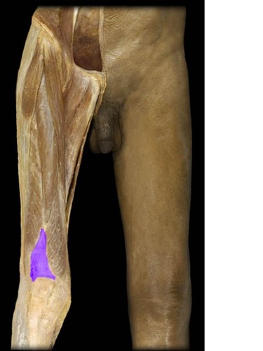 Extension of leg
Flexion of thigh at hip joint (rectus femoris only)