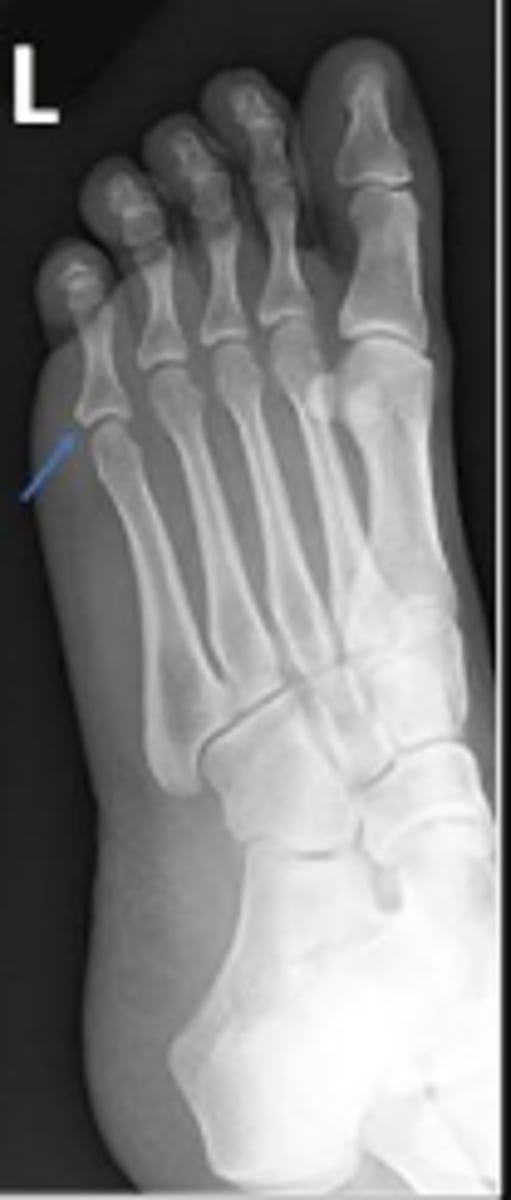 <p>What are the arrows pointing to?</p>