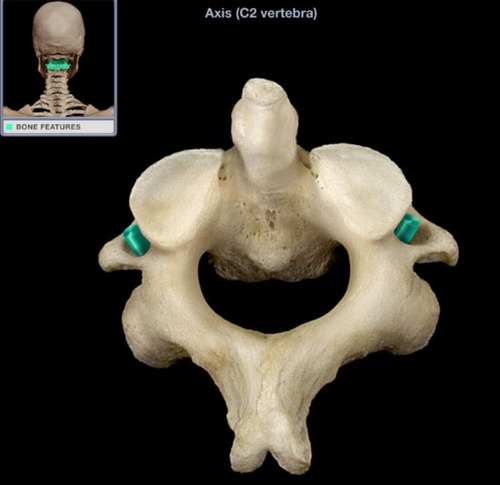<ul><li><p>for vertebral artery</p></li></ul><p></p>