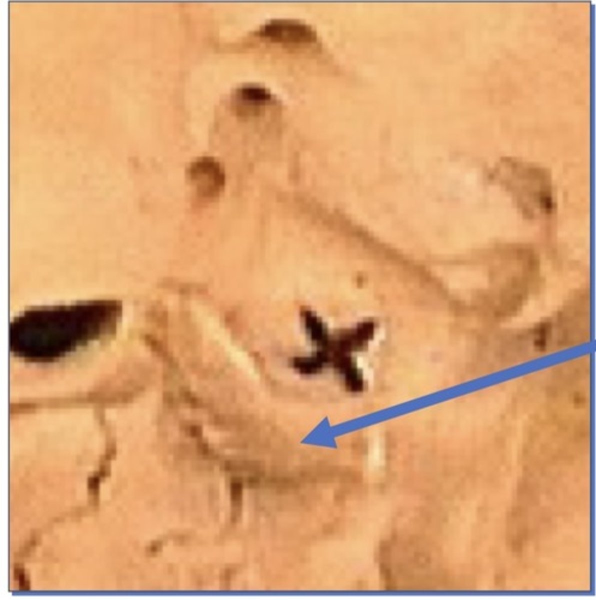 <p>1. Posterior to sella turcica</p>