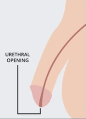 <p>where is the normal opening of the urethral for a penis?</p>