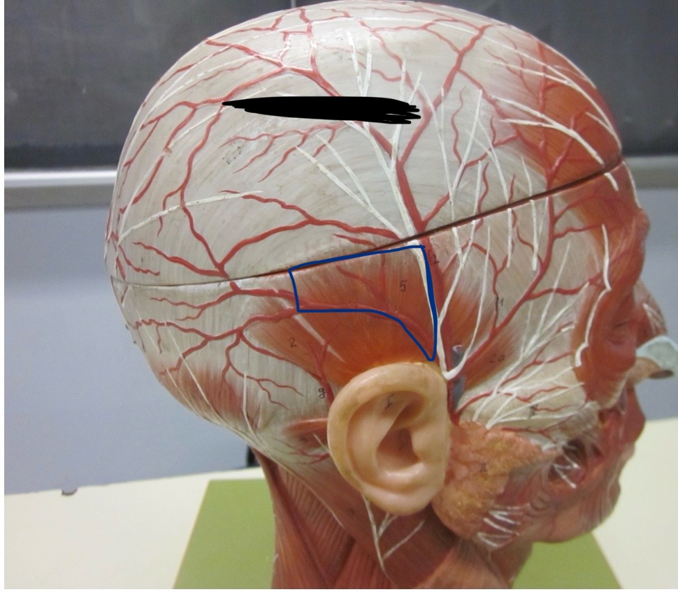 <p>Which muscle</p>
