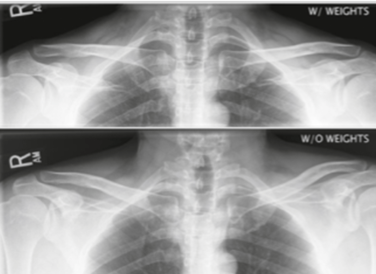 <p>1. What projection is shown in the image?</p><p>2. What are the clinical indications for this projection?</p><p>3. Is this an optimal image?</p><p>4. Name all of the anatomy.</p><p>5. Does this image meet all criteria?</p><p>6. Where is the CR placed?</p><p>7. If applicable, what method is interchangeable with this projection?</p>