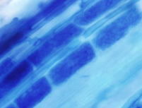 <p>What is <strong>arbuscular mycorrhiza?</strong></p><p>What part in the diagram shown is the arbuscle? What are they connected by?</p><p>What is the <strong>extra-radical mycelium?</strong></p><p>How long do arbuscules last for? (days)</p>