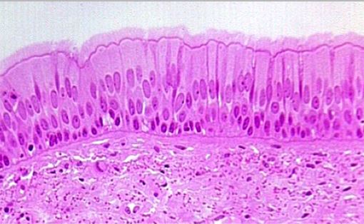 <p>What epithelial tissue is this?</p>